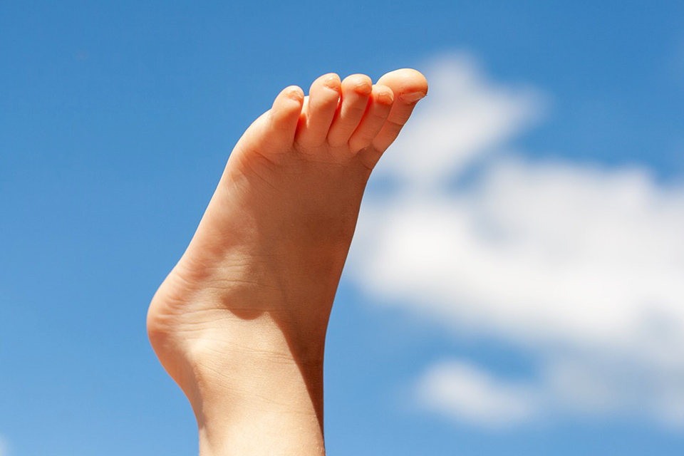 你試過用這些偏方治香港腳嗎？ 下場有可能導致蜂窩性組織炎！