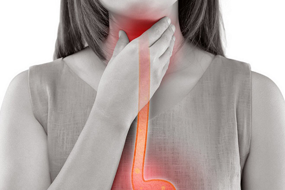 胃食道逆流除了感到「心燒心」 吞嚥困難、打嗝不止、講話燒聲都是異常警訊長期輕忽恐增食道癌風險